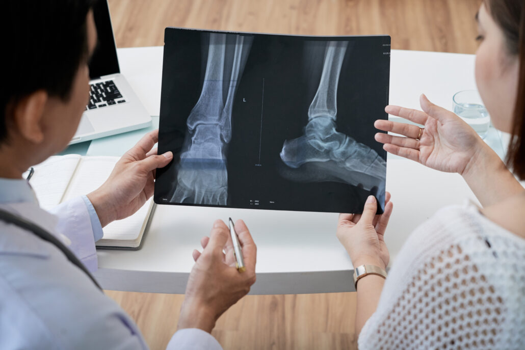 Médico homem apresentando radiografia dos pés a uma mulher, representando os biomateriais para regeneração óssea